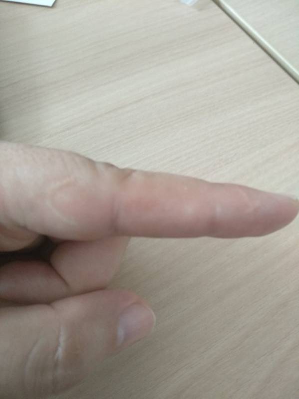 Факт: почти каждый мужчина имеет шрам на левом указательном пальце