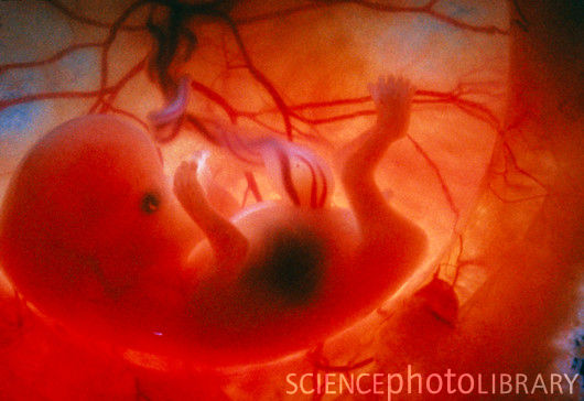 20 фото о том, как развивается ребенок в утробе матери