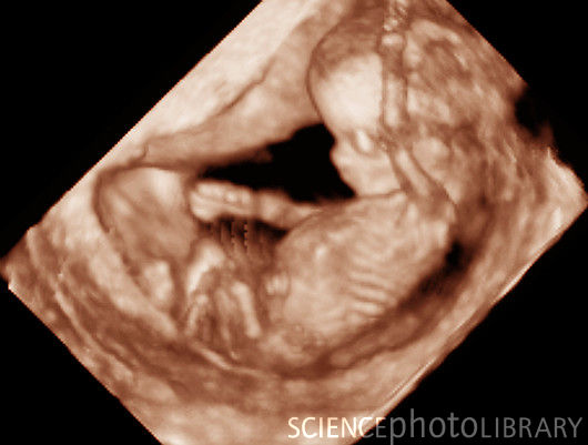 20 фото о том, как развивается ребенок в утробе матери