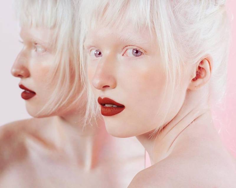 Девушку-альбиноса обижали в школе из-за странной внешности. А она выросла и покорила мировые подиумы