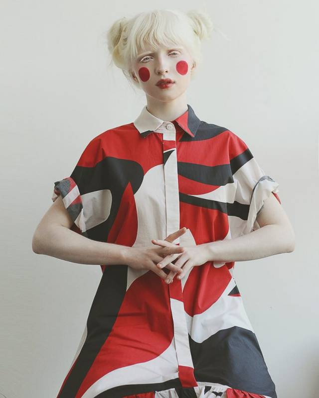 Девушку-альбиноса обижали в школе из-за странной внешности. А она выросла и покорила мировые подиумы
