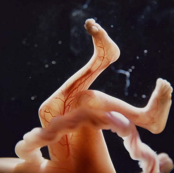 Уникальный фотопроект: «Жизнь ребенка до рождения»