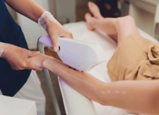 Лазерная эпиляция и 5 преимуществ перед удалением волос воском