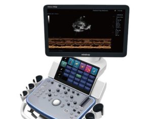 УЗИ аппараты: Как выбрать идеальное оборудование для вашей медицинской практики